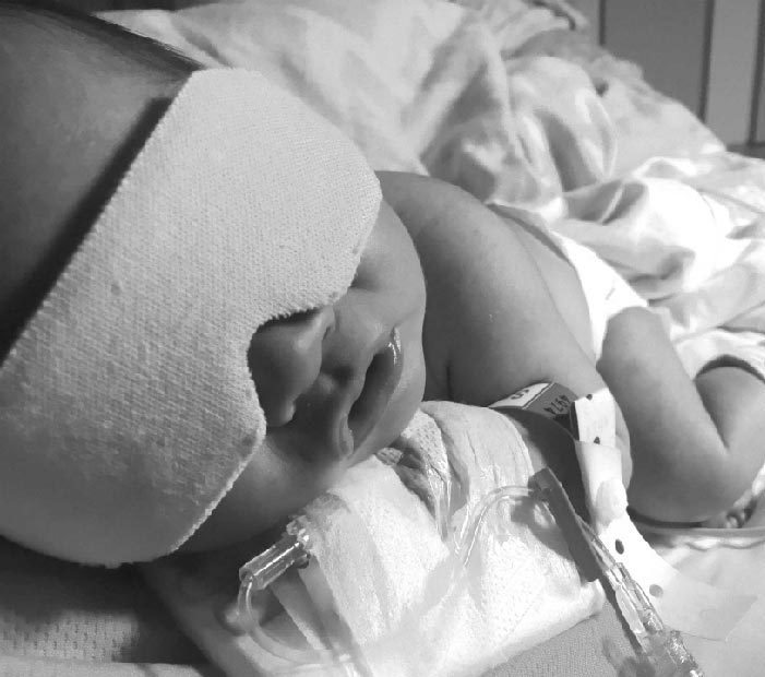 Colson in the NICU