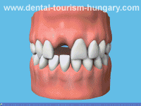 software dental fidelizar pacientes video