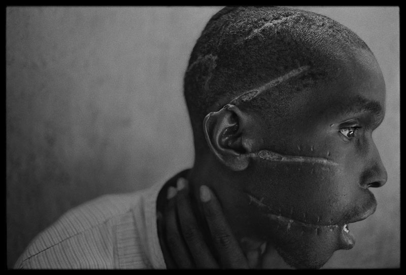 foto: James Nachtwey | Hutu man, Rwanda 2004
