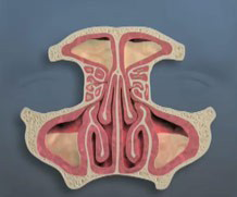 Endoscopic Sinus Surgery - Sinus Disease