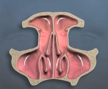 Endoscopic Sinus Surgery - Sinus Drainage