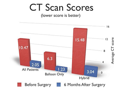 CT Scan Scores Chart