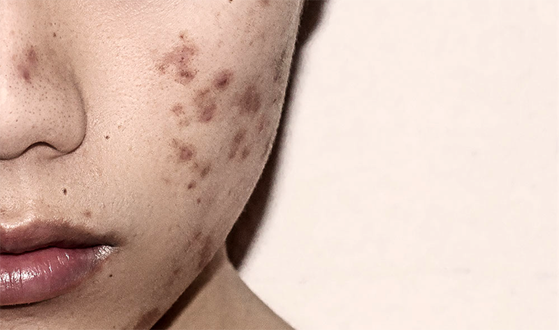 Get smooth skin from top to toe