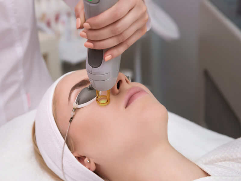 hyperpigmentation treatment picocare fractional laser amaris b clinic