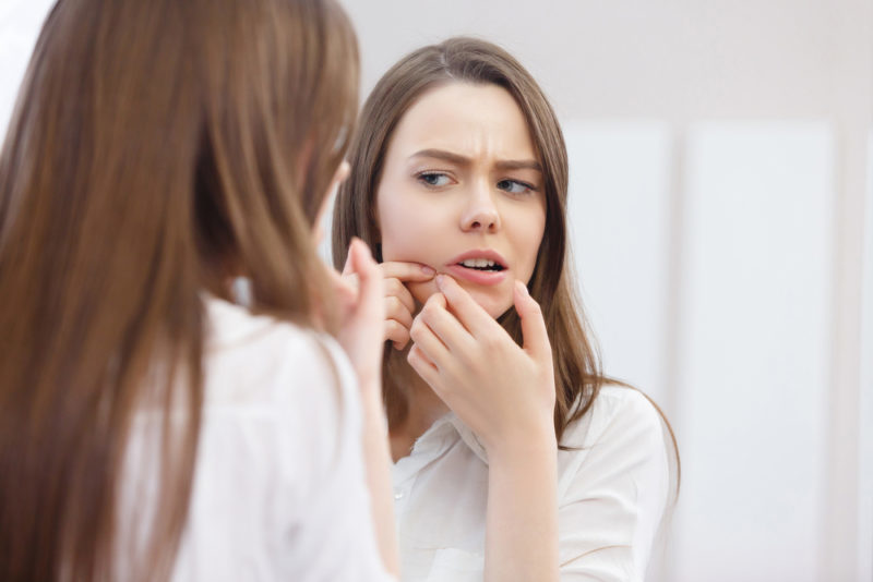 acne scars skin laser facial amaris b clinic