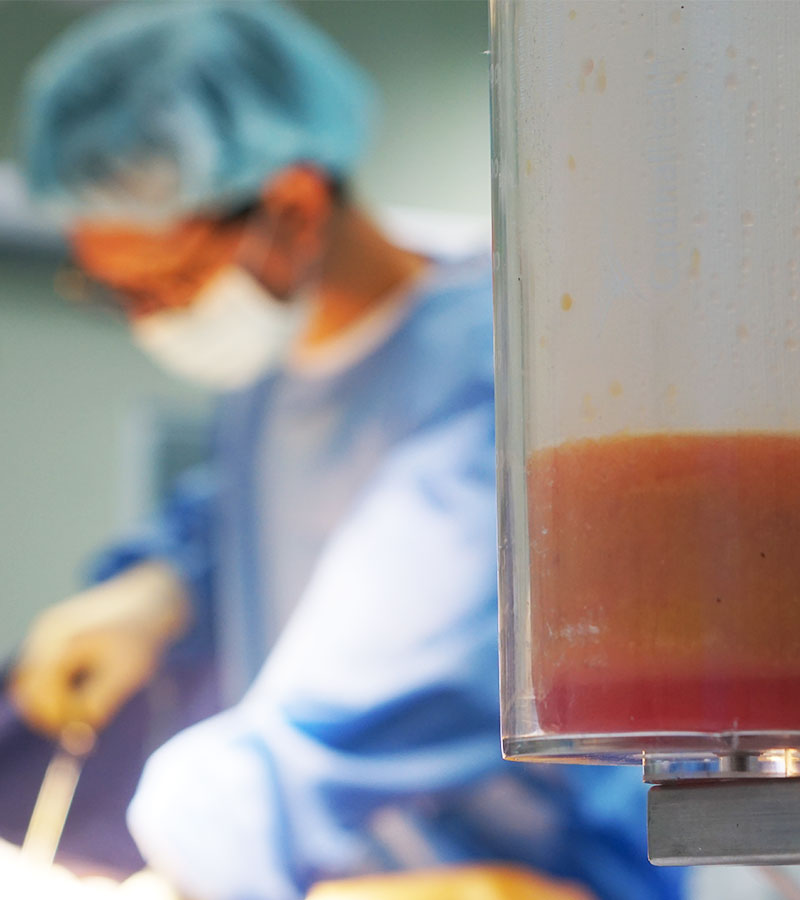 How to lose Thigh Fat, Saddlebags & Knee Fat