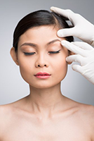 Brow Lift Patient