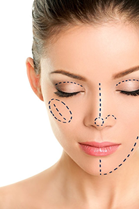 rhinoplasty patient