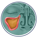 Locate Sinus Infection