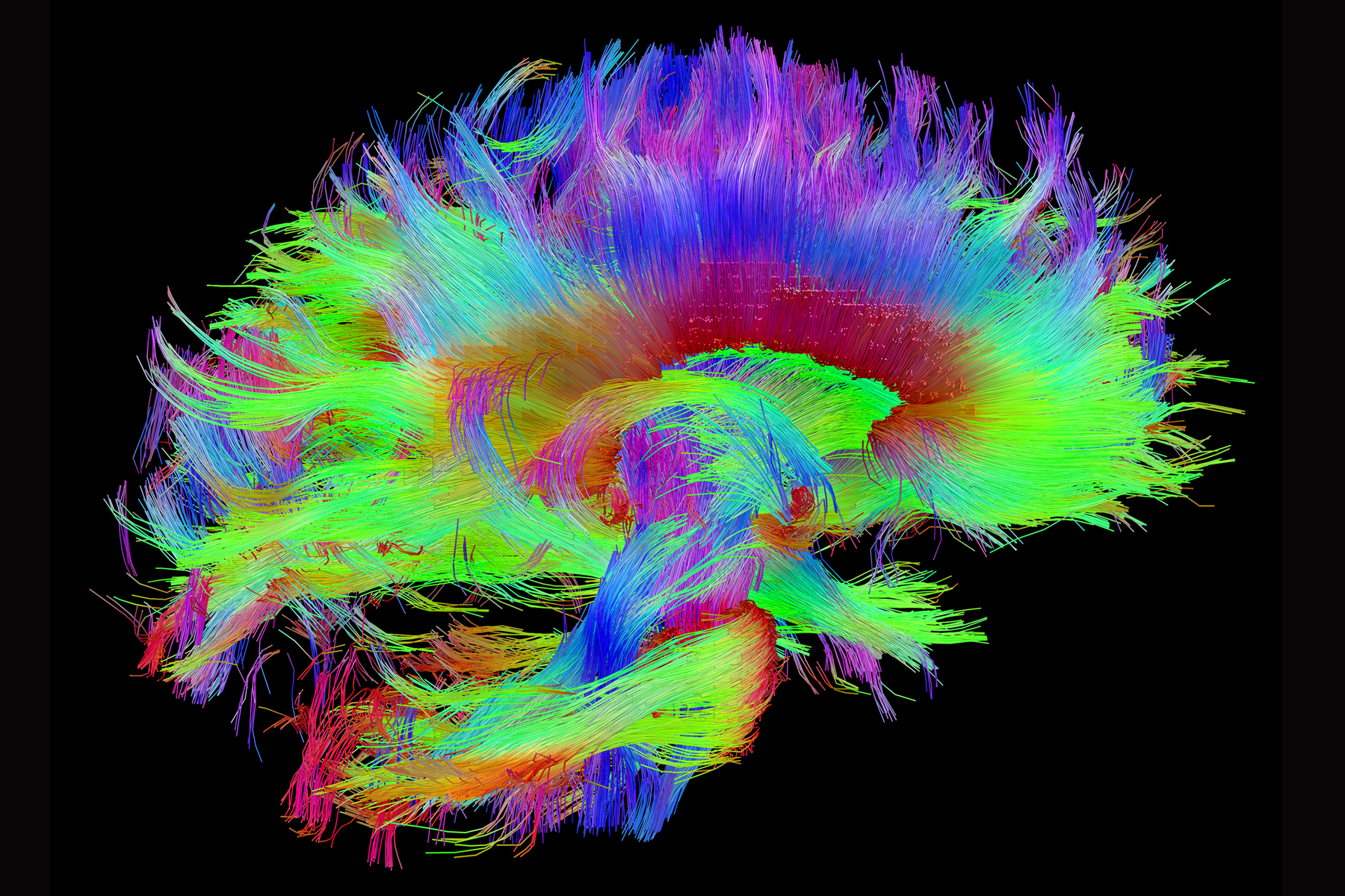 Finding learning in unexpected places in the brain