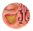 Balloon Sinus Dilation Process - Step 1: Locate