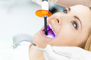 In-Office Best Teeth Whitening Services