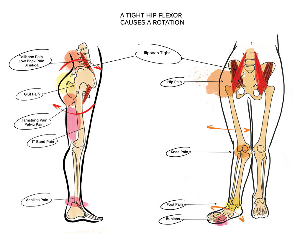 Tight Hip Flexor Physical Therapy Christine Koth Holistic PT
