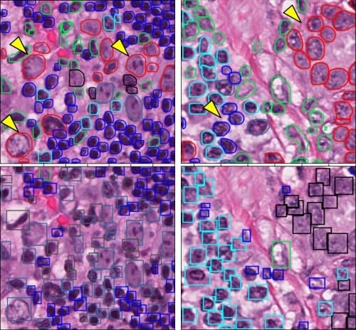 Computational and Integrative Pathology Group