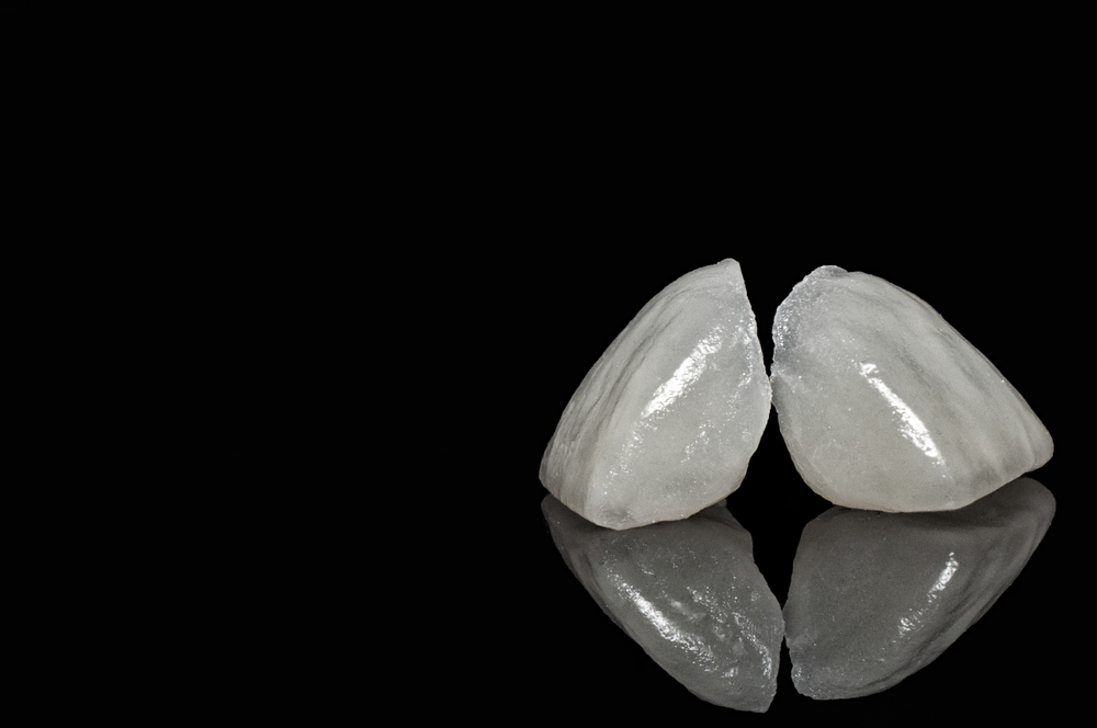 Porcelain Veneers
