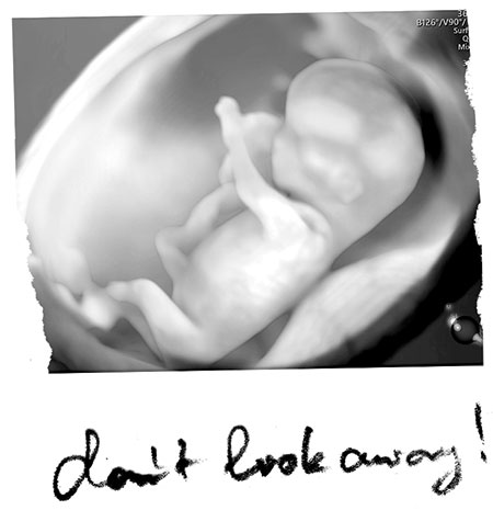 Heartbeat: Life, Choice, and Abortion.