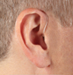 Hearing Aids - Behind the Ear (BTE)