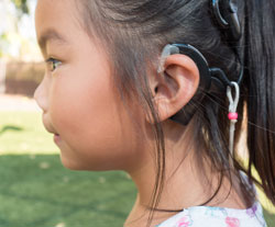 Cochlear Implants for Children