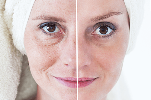 Aging Skin, Consequences of Aging