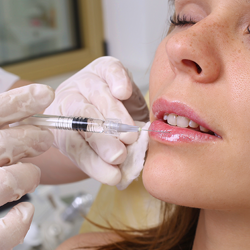 Lip injectible, Lip filler