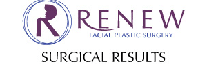 Renew Earlobe Repair Logo