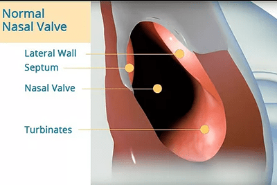 Normal Nasal Valve
