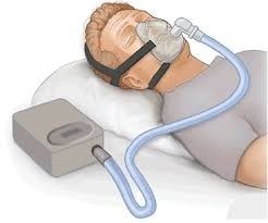 CPAP Sleep Apnea Services
