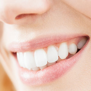 perfect smile with no chips
