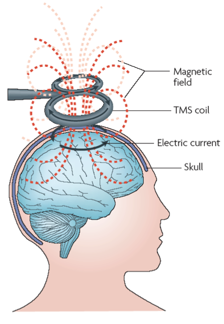 how rTMS works