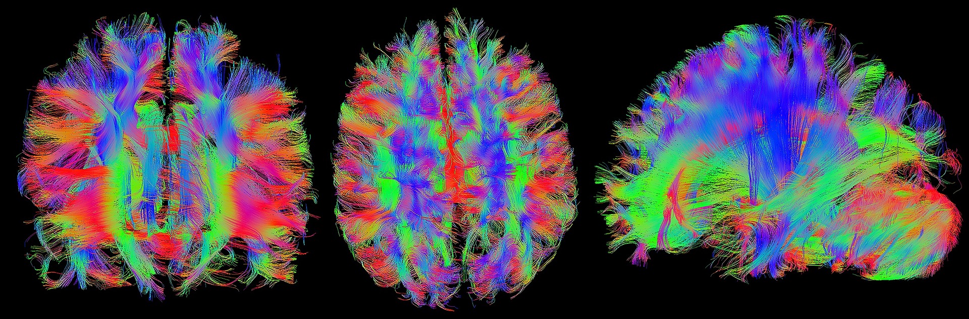 fluorescent colored brain illustrations