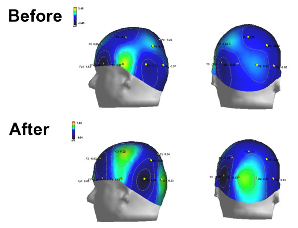 Figure from the study showing the results