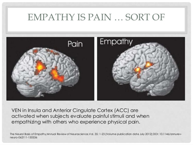 Visual representation of empathy and pain in the brain