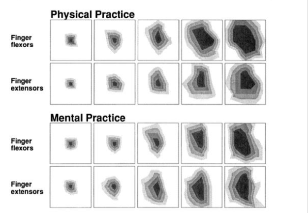 Fine motor skills enhanced by physical practice versus mental practice