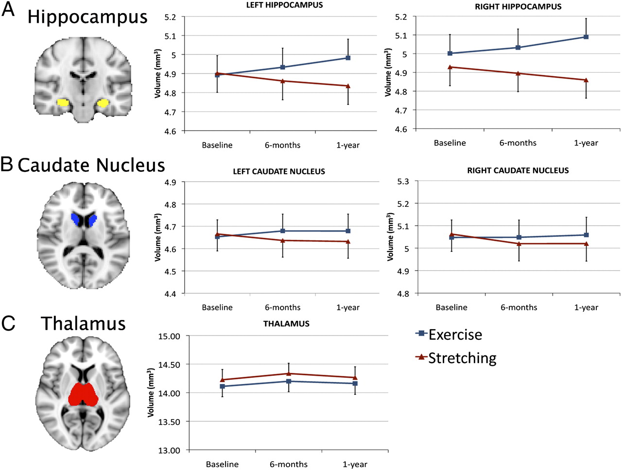 Effects of exercise on the hippocampus, caudate nucleus, and thalamus.