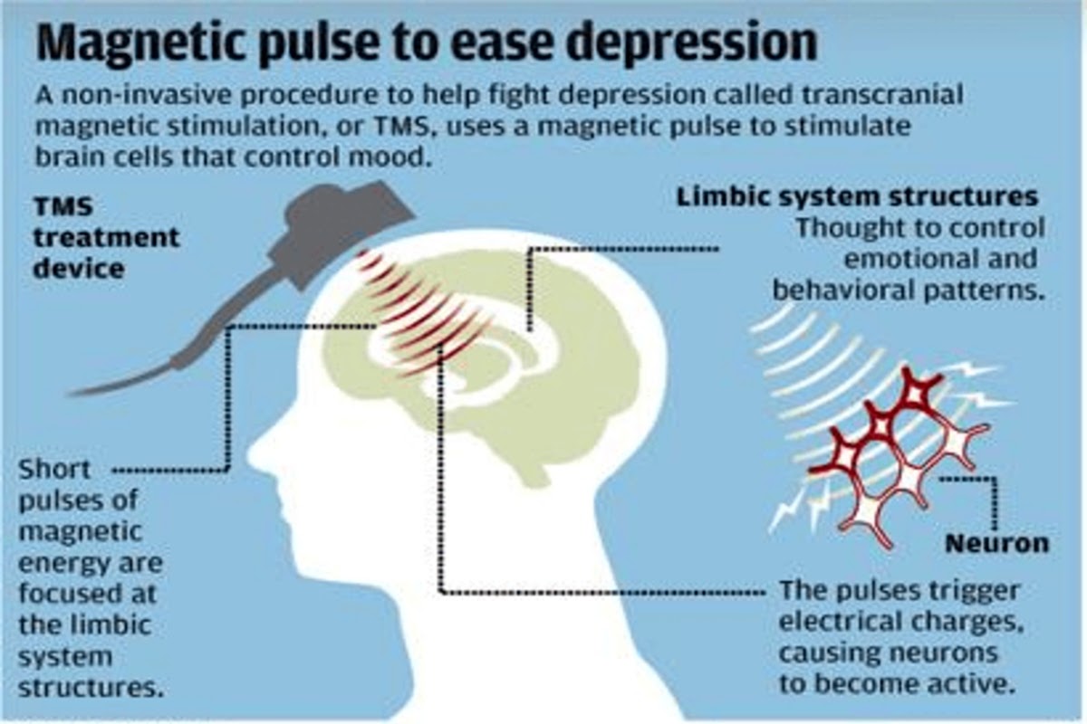Diagram of TMS