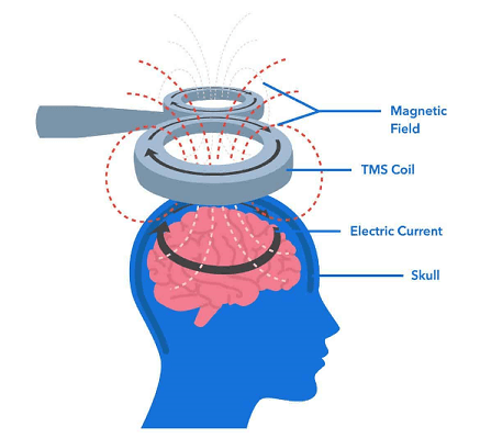 how tms works