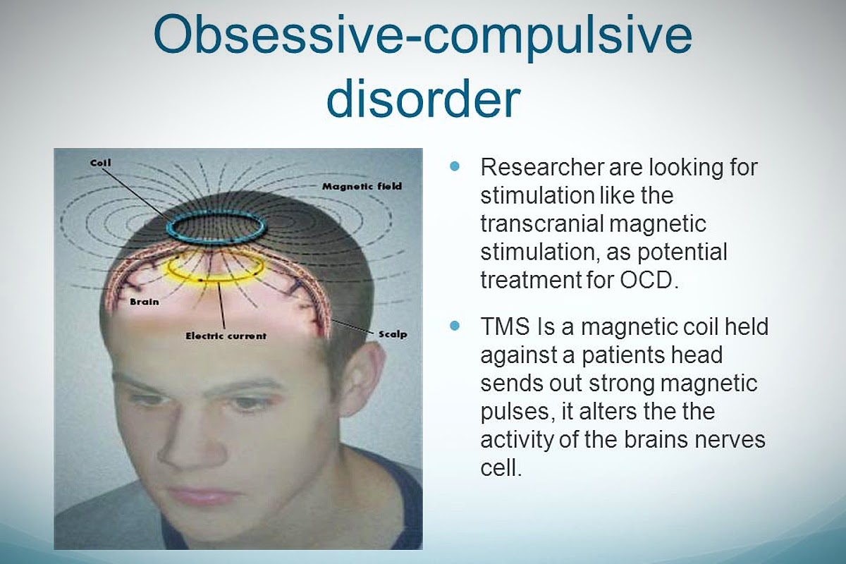 chart of how tms treats ocd