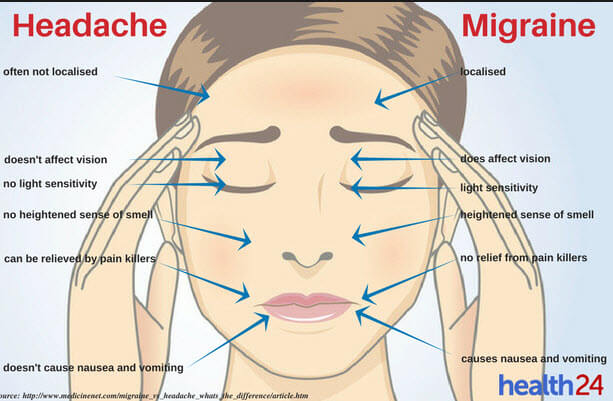 headache vs migraine