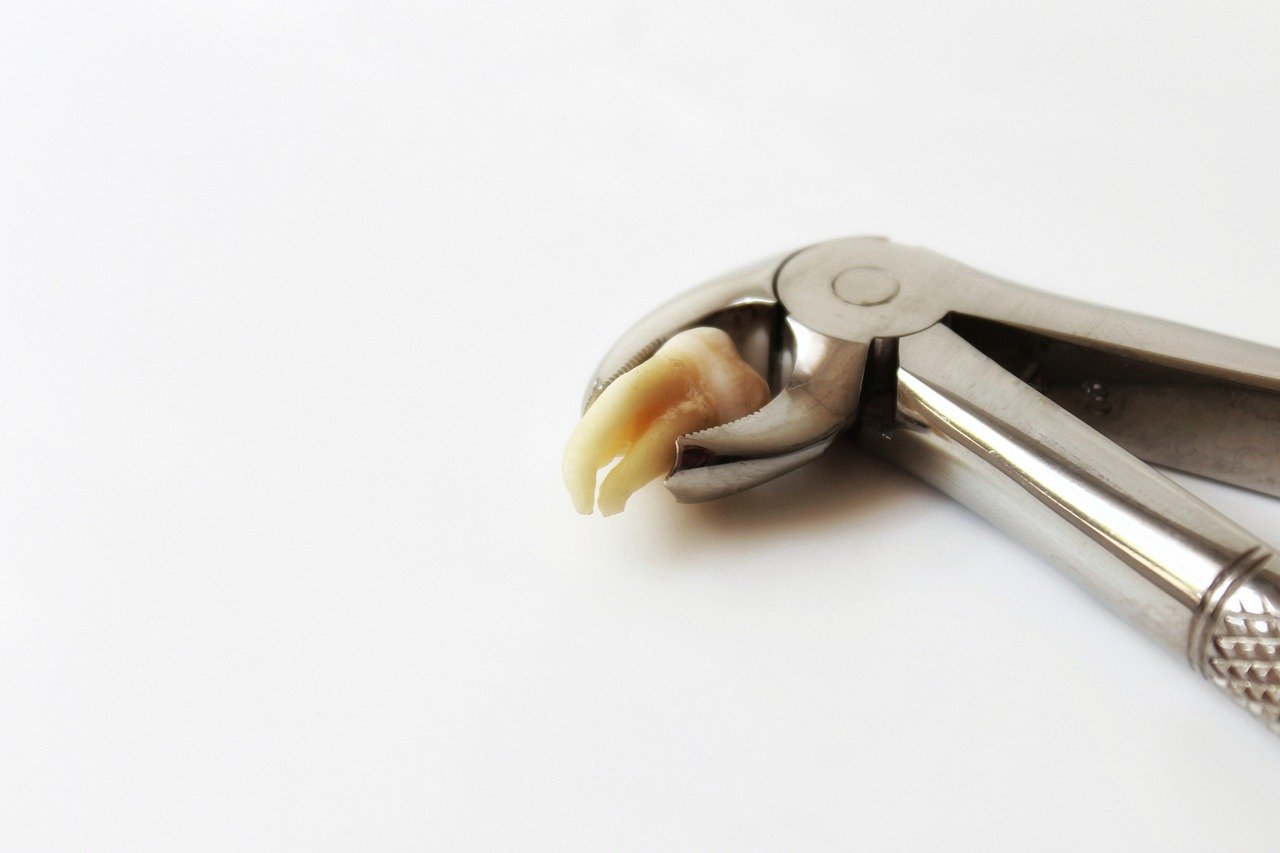 Pliers holding a removed molar