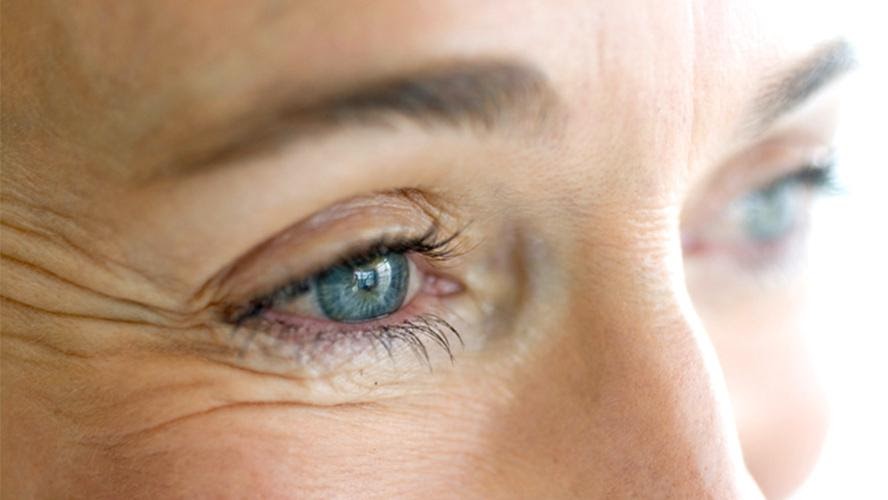 A woman's blue eyes are shown with crow's feet wrinkles.
