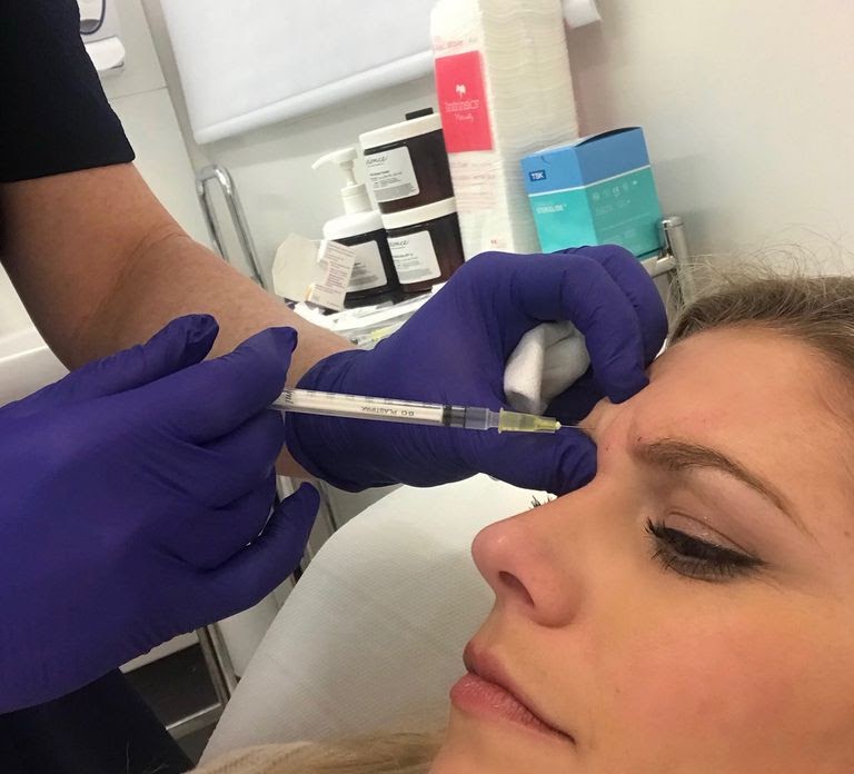 a woman receiving Botox injections in her forehead
