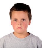Common salivary gland problems include obstruction and infection.