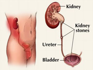 Body diagram of the kidneys
