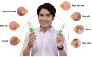 2.Vernicers Acne : kem trị mụn số 1 của Ý – thổi bay các loại mụn cứng đầu nhất