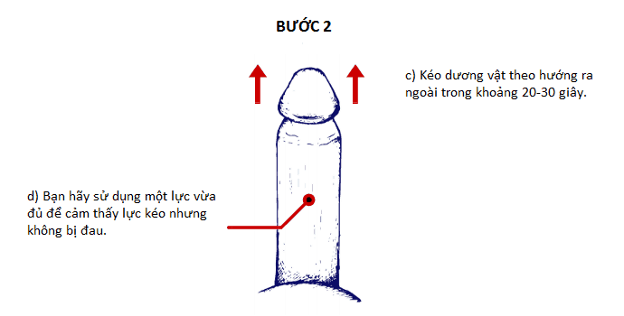 2.Cách làm to dương vật Ultimate Stretch