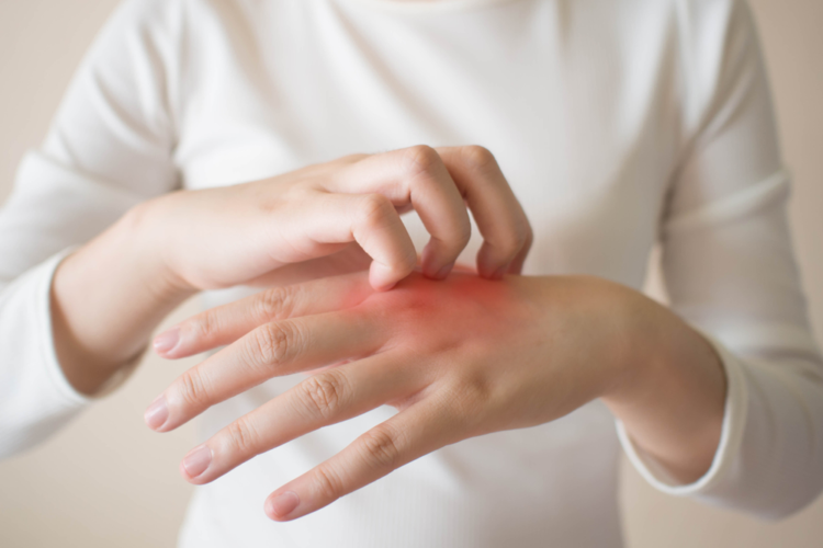 dấu hiệu nhiễm HIV