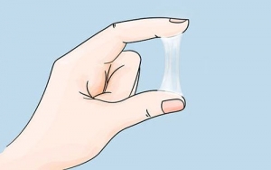 Dấu hiệu viêm cổ tử cung nhẹ