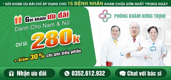 Ưu đãi