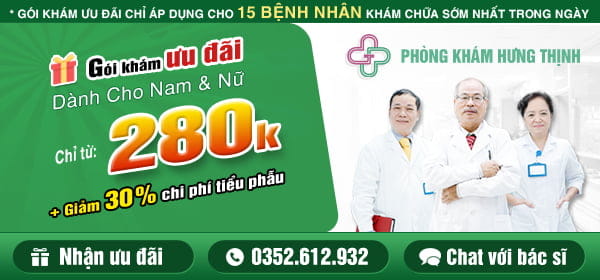 Ưu đãi