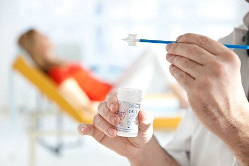 Chi phí xét nghiệm sùi mào gà bao nhiêu tiền?